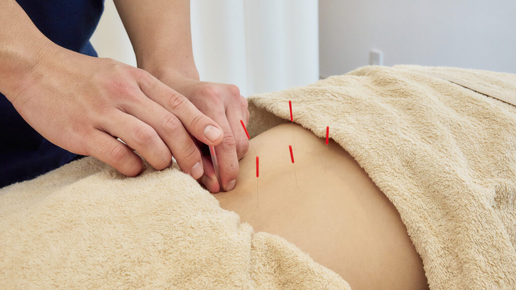 川崎市腰痛専門整体鍼灸